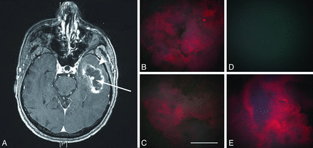 Fig 4.