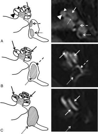 Fig 1.
