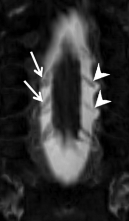 Fig 4.