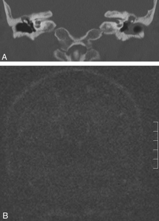 Fig 3.
