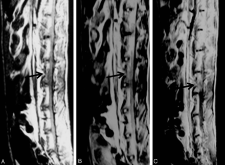 Fig 4.