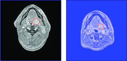 Fig 2.