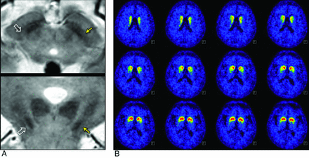 Fig 4.