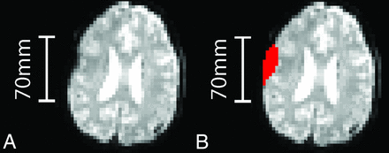 Fig 1.