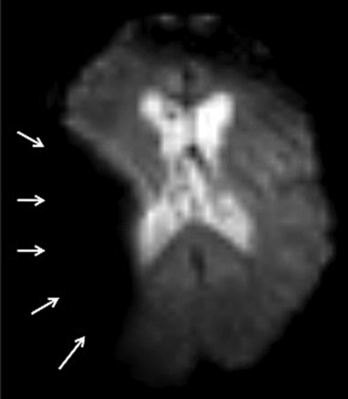 Fig 5.
