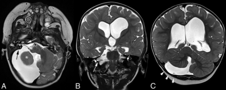 Fig 3.