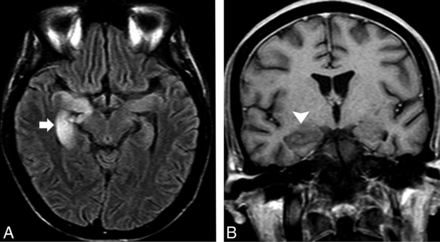 Fig 3.