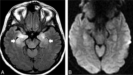 Fig 5.