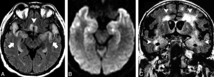 Fig 6.