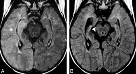 Fig 8.