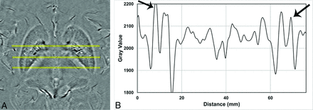 Fig 1.