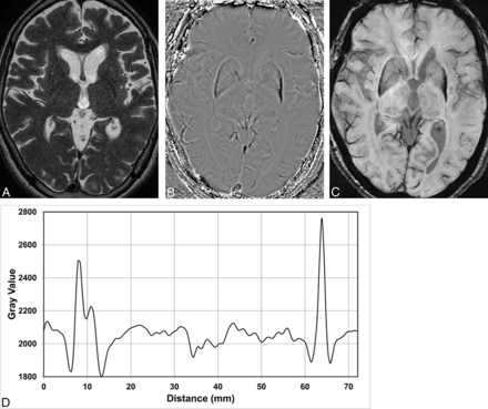 Fig 3.