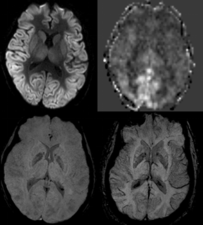 Fig 2.