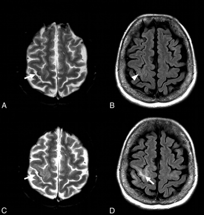 Fig 4.