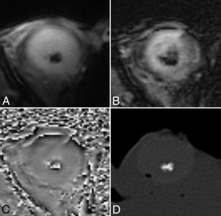 Fig 4.