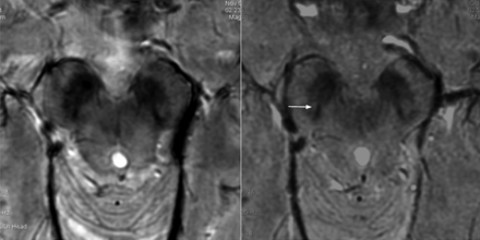 Fig 3.