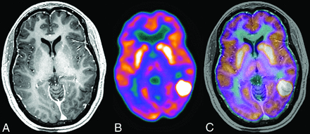 Fig 4.
