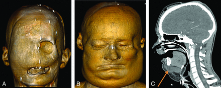 Fig 2.