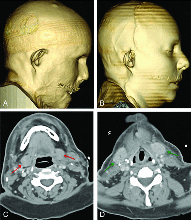 Fig 5.