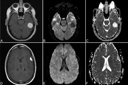 Fig 2.