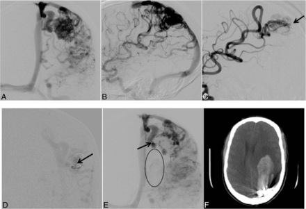 Fig 2.