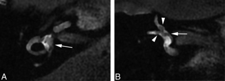 Fig 2.