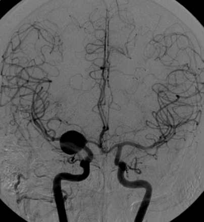 Fig 1.