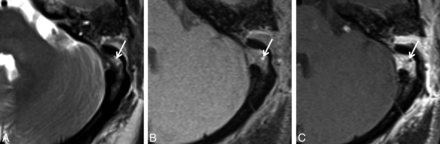 Fig 4.