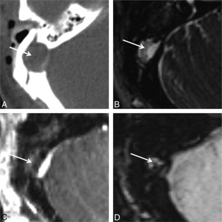Fig 5.