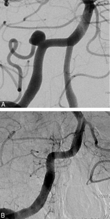 Fig 3.