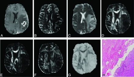 Fig 2.
