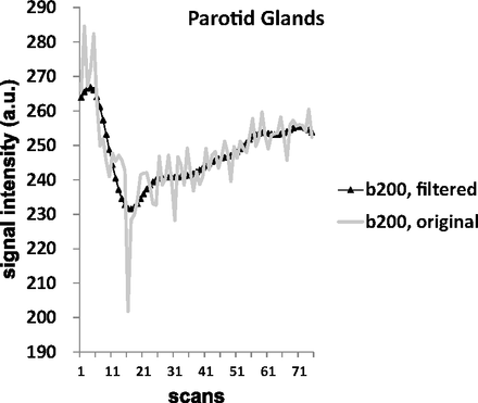 Fig 2.