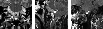 Fig 1.