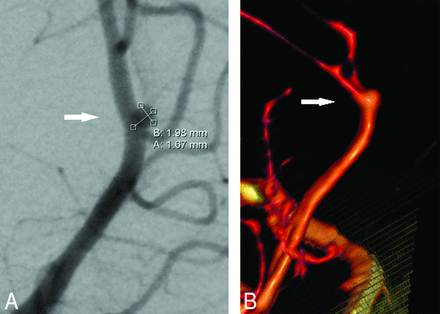 Fig 2.