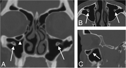 Fig 4.