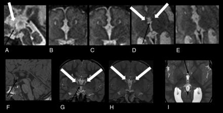 Fig 3.