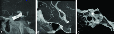 Fig 2.