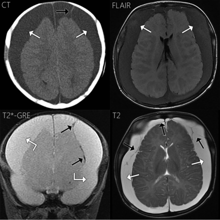 Fig 5.