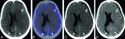 Fig 3.