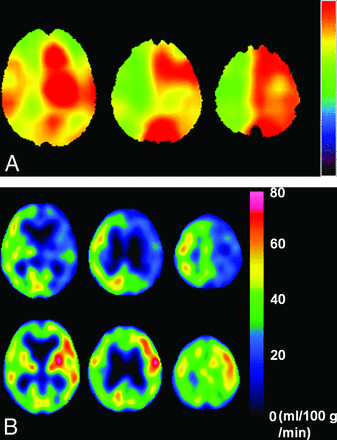 Fig 4.
