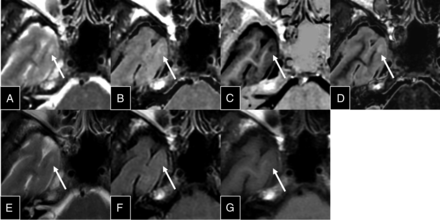 Fig 4.