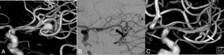 Fig 3.