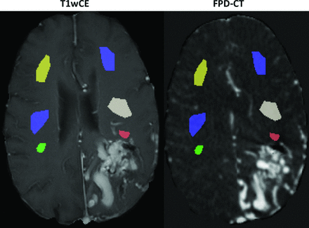 Fig 2.