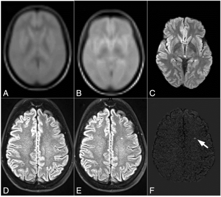 Fig 2.