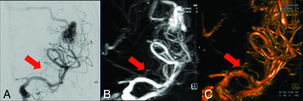Fig 5.