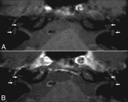 Fig 3.