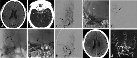 Fig 1.