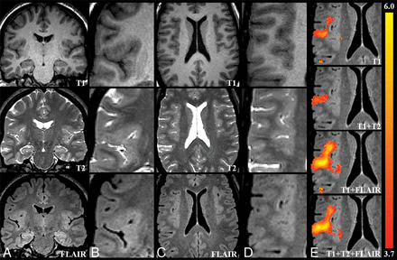 Fig 2.