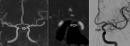 Fig 6.