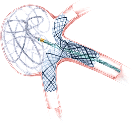 Fig 1.